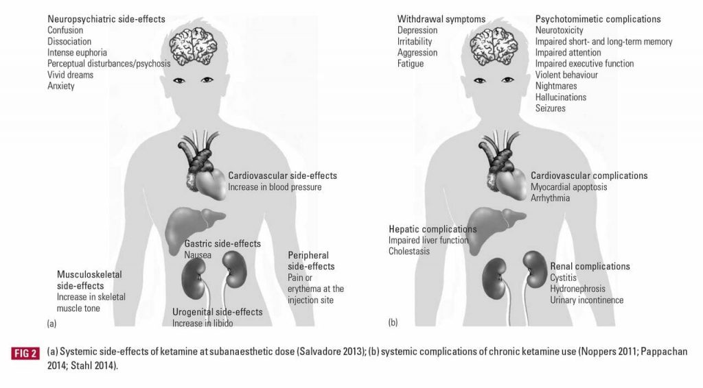 ketamine addiction